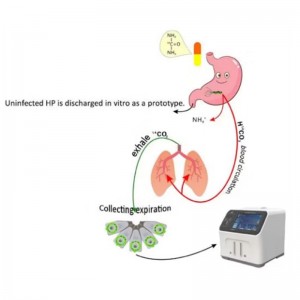 ¹⁴C-Urea Breath Test Analyzer: Golden standard  for Gastric Helicobacter pylori Detection