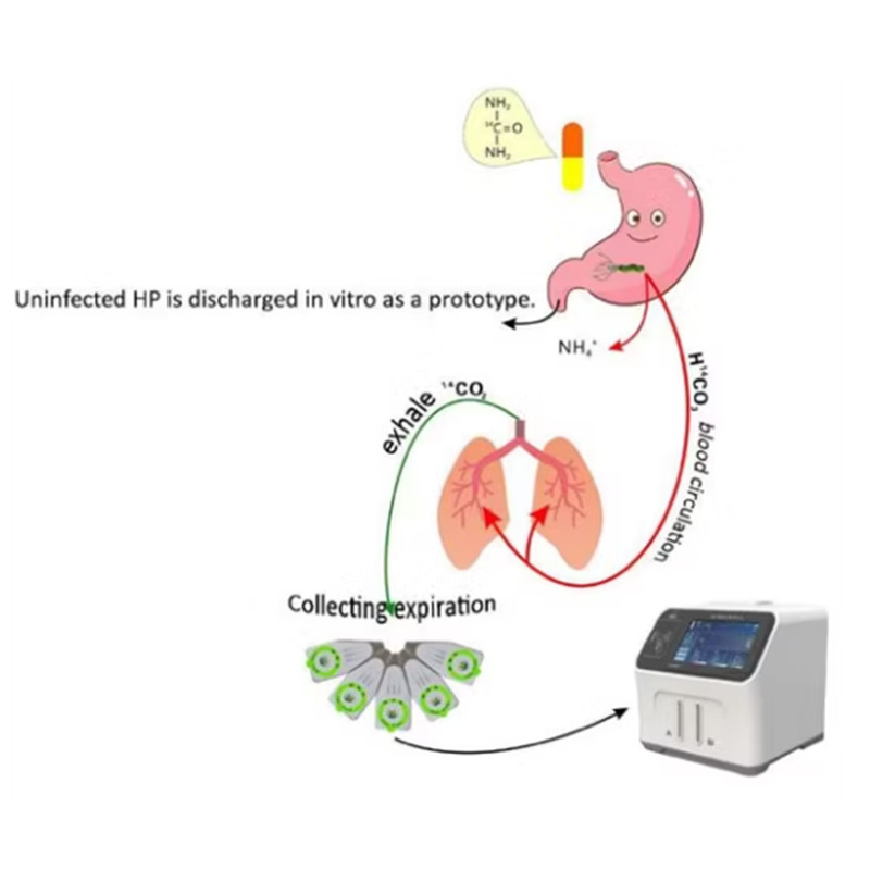 ¹⁴C-Urea Breath Test Analyzer: Golden standard  for Gastric Helicobacter pylori Detection