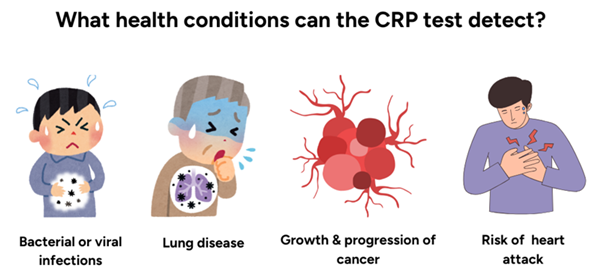 crp-test-detects_2