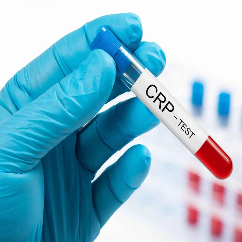 C-Reactive Protein: Your Body’s “Alarm System” – How Much Do You Know?