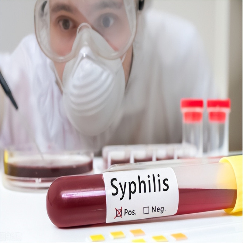 How much do you know about syphilis？