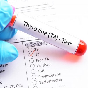 A Comprehensive Guide to TT4: A Key Indicator of Your Thyroid Health
